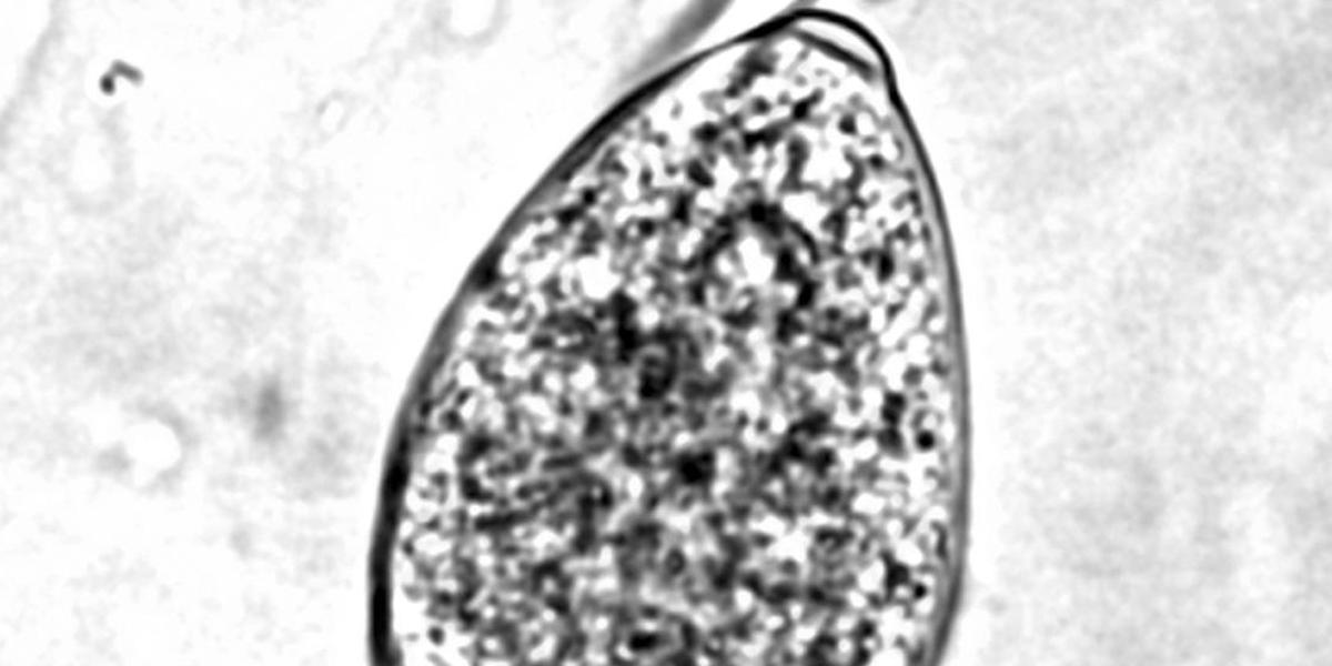 Sporangia of P. ramorum