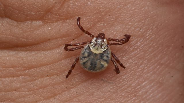 An American dog tick on someone's hand.