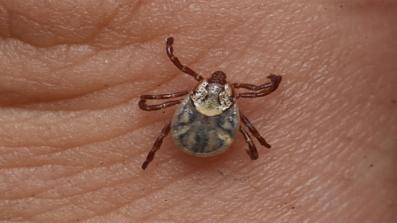 An American dog tick on someone's hand.