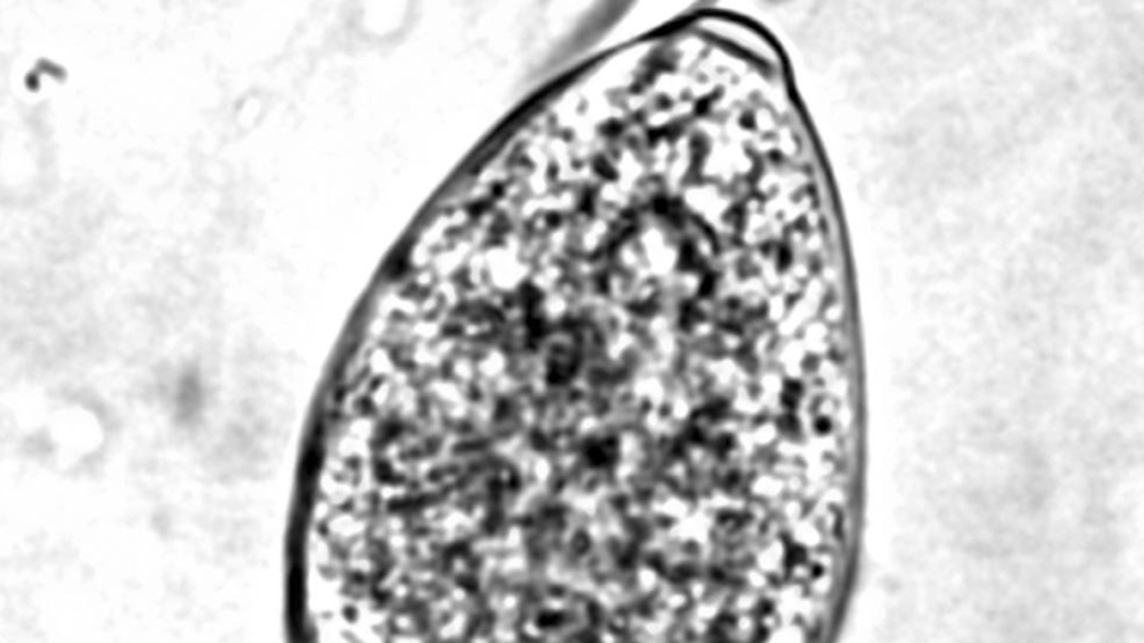 Sporangia of P. ramorum